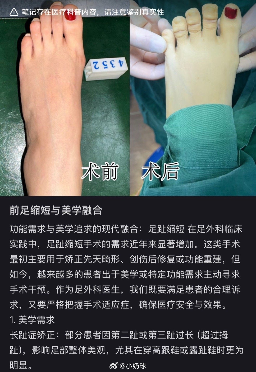 3CD有意思福利有趣图【第91期】电竞女友-3CD