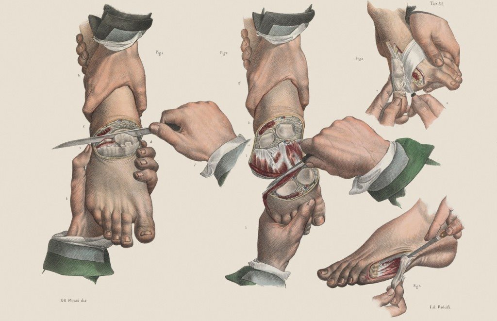 医学历史作家Richard Barnett记载的19世纪外科手术进化过程，用了很多插图来还原当时的治疗方式和解剖成果