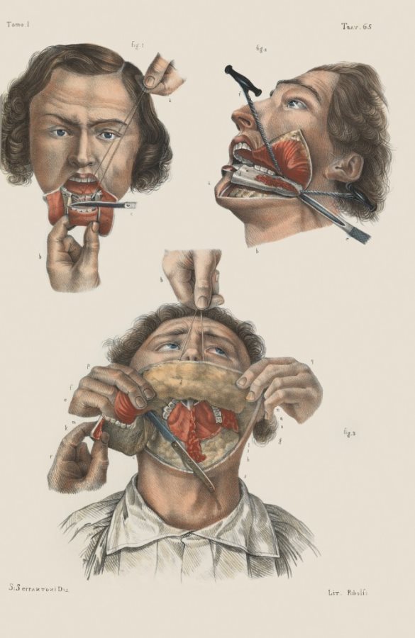 医学历史作家Richard Barnett记载的19世纪外科手术进化过程，用了很多插图来还原当时的治疗方式和解剖成果