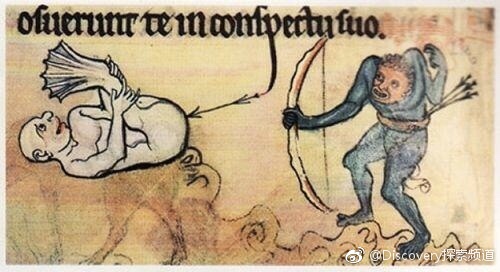 中世纪人迷信灌肠可以包治百病