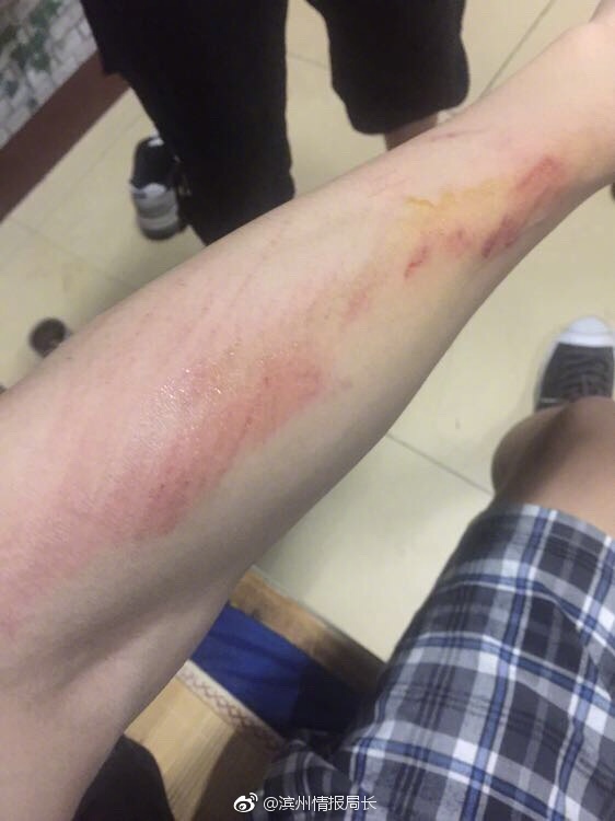 一大学生因在学校内被女朋友抱了一下，与自律会起争执被围殴。