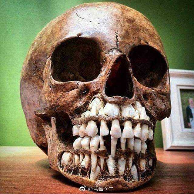 儿童的颅骨，很好地说明了乳牙和恒牙的关系。（伸入，希望没有惊吓到各位。