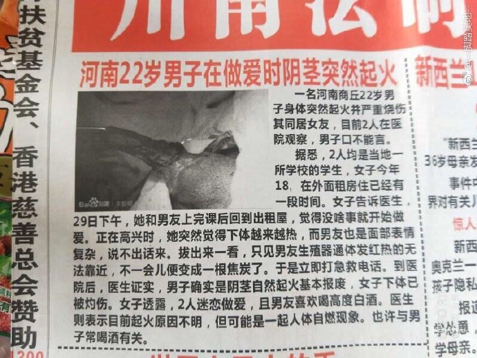 割了吧，都烧焦了