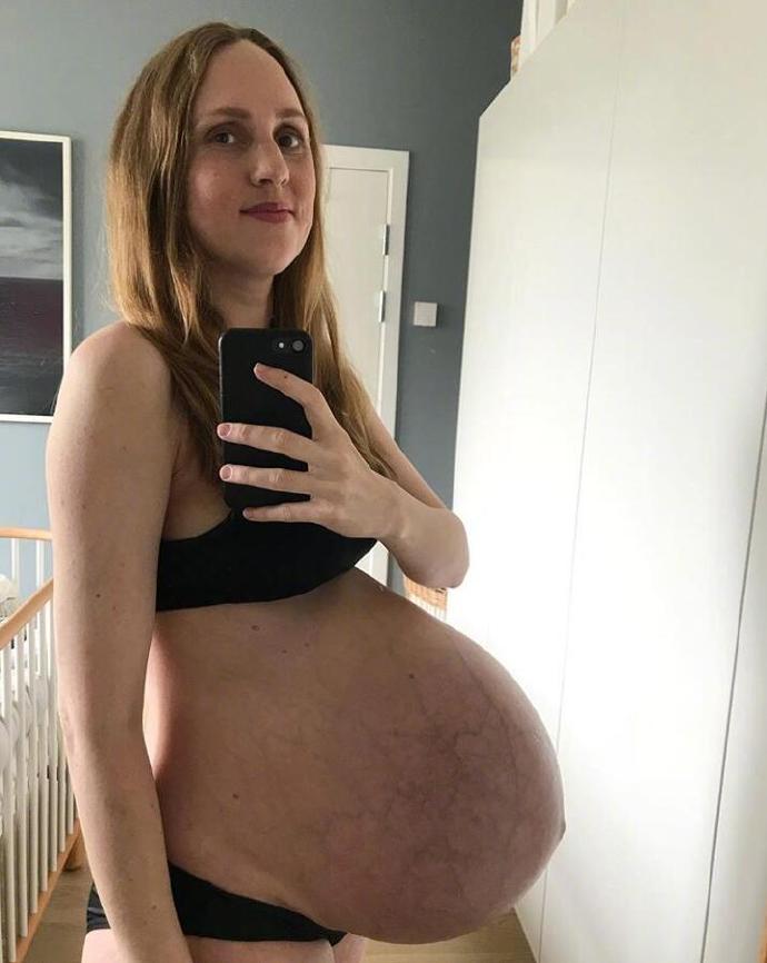 一位怀着三胞胎的妈妈用照片记录下了自己身体的变化